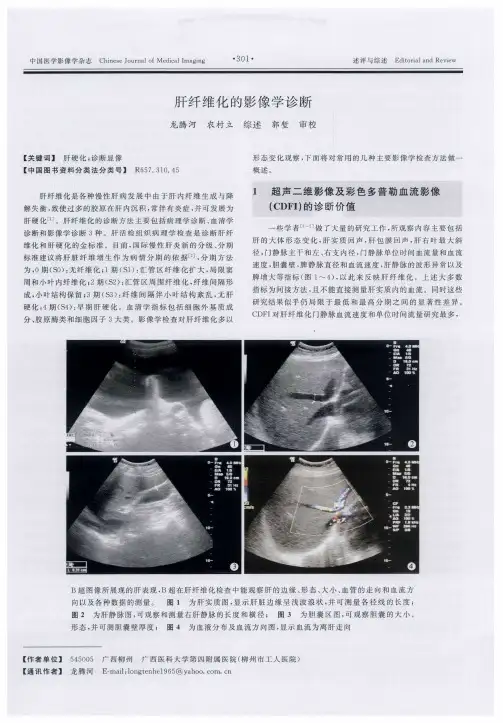 肝纤维化的影像学诊断