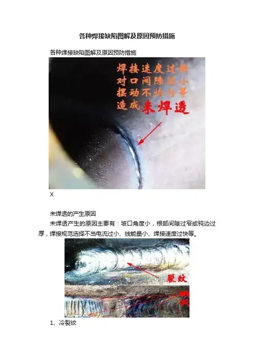 各种焊接缺陷图解及原因预防措施