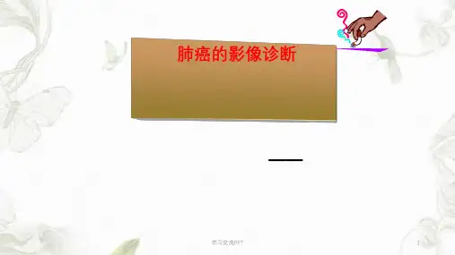 肺癌的影像诊断课件