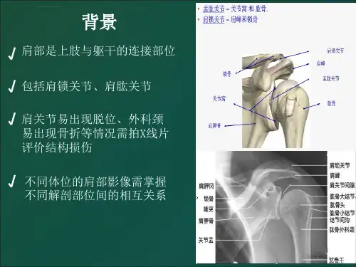 肩关节X线检查ppt课件