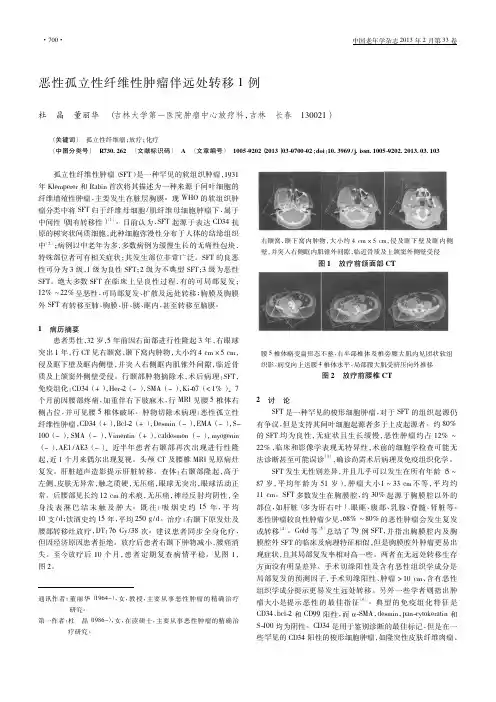 恶性孤立性纤维性肿瘤伴远处转移1例