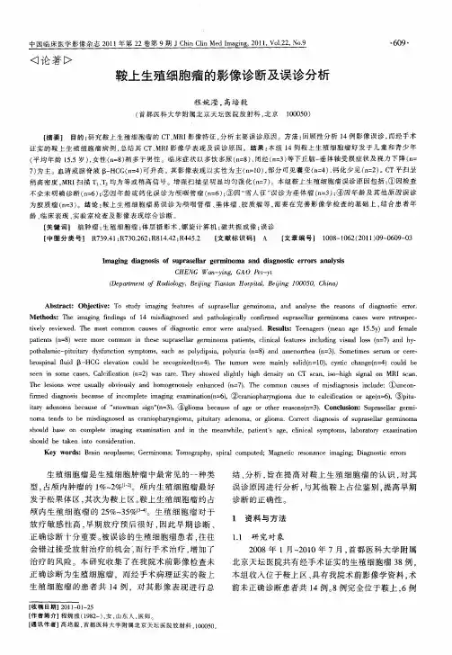 鞍上生殖细胞瘤的影像诊断及误诊分析