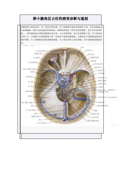 桥小脑角区占位性病变诊断与鉴别
