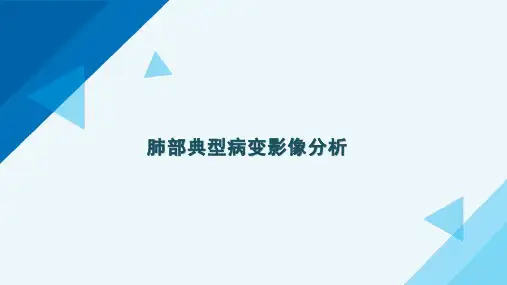 肺部常见疾病的影像表现