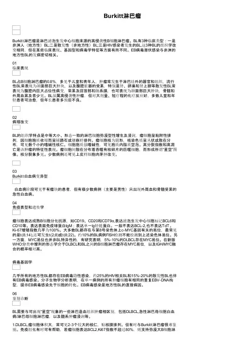 Burkitt淋巴瘤