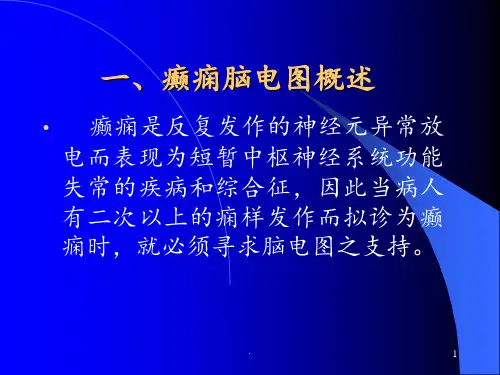 癫痫脑电图幻灯片ppt课件