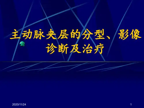 主动脉夹层的分型影像诊断及治疗 ppt课件