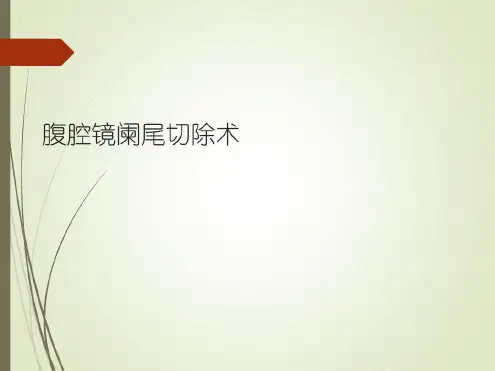 腹腔镜阑尾切除术