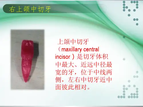 右上颌中切牙