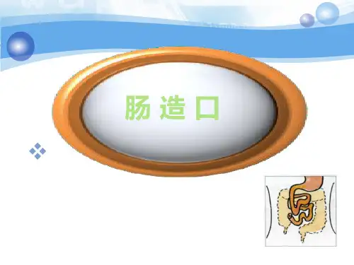 肠造瘘术ppt课件
