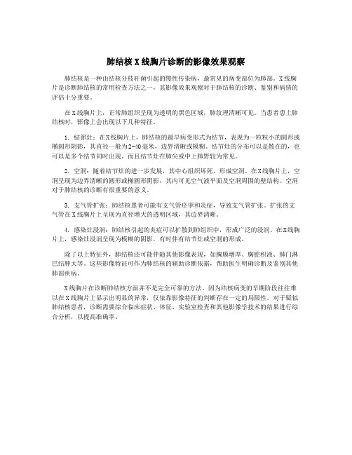 肺结核X线胸片诊断的影像效果观察