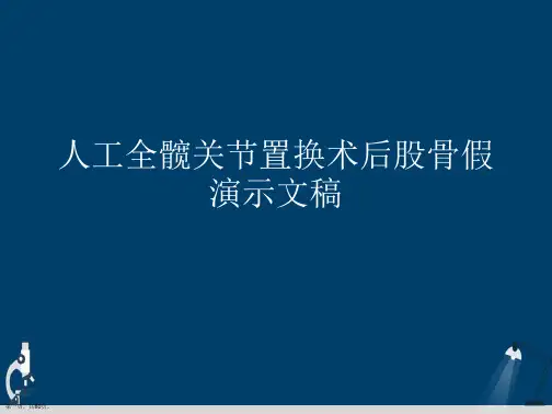 人工全髋关节置换术后股骨假演示文稿