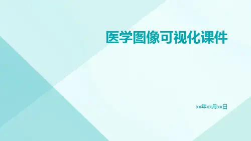 医学图像可视化课件