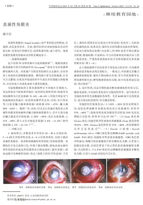 真菌性角膜炎
