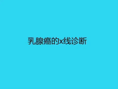 【全面版】乳腺癌的x线诊断 ppt课件PPT文档