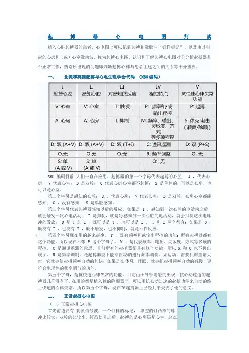 起搏器心电图判读