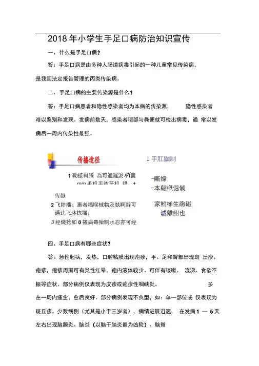 手足口病防治知识宣传