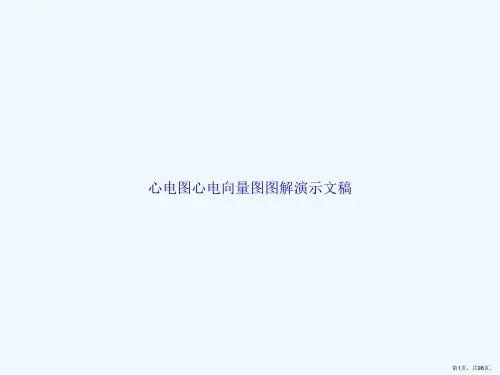心电图心电向量图图解演示文稿