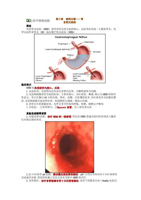 病例分析——胃食管反流病