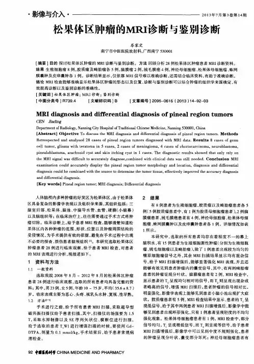 松果体区肿瘤的MRI诊断与鉴别诊断