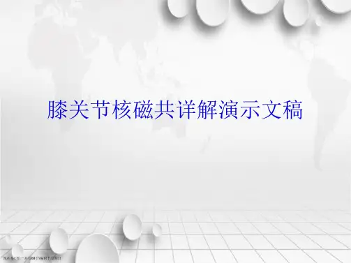 膝关节核磁共详解演示文稿