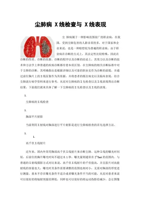 尘肺病X线检查与X线表现