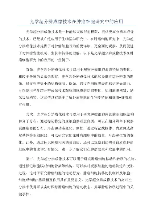光学超分辨成像技术在肿瘤细胞研究中的应用