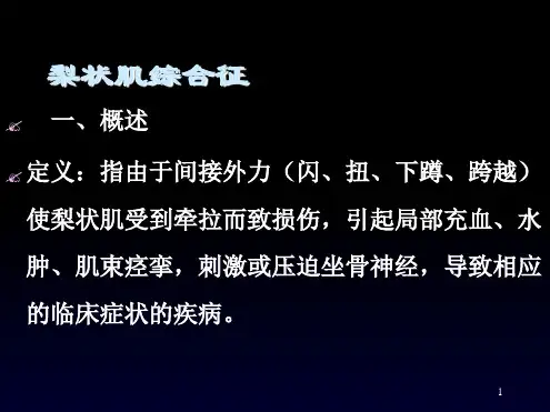 梨状肌综合征ppt课件