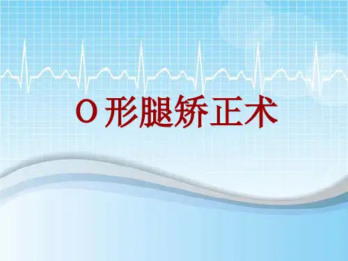 手术讲解模板：O形腿矫正术