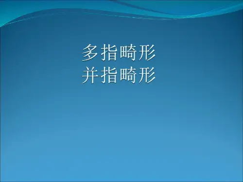 多指并指畸形剖析