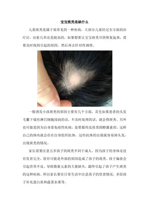 宝宝斑秃是缺什么
