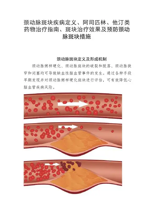 颈动脉斑块疾病定义、阿司匹林、他汀类药物治疗指南、斑块治疗效果及预防颈动脉斑块措施