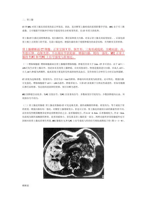 肾上腺CT与MRI诊断