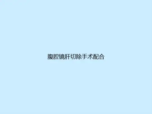 腹腔镜肝切除手术配合