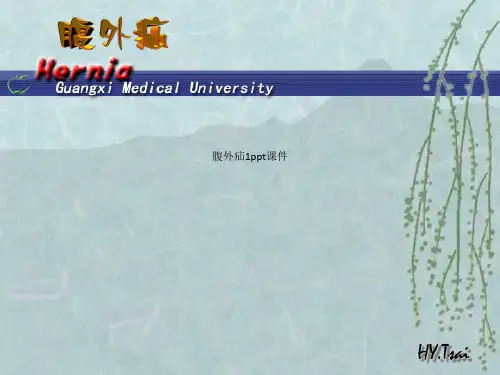 腹外疝1ppt课件