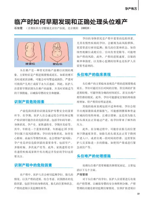 临产时如何早期发现和正确处理头位难产