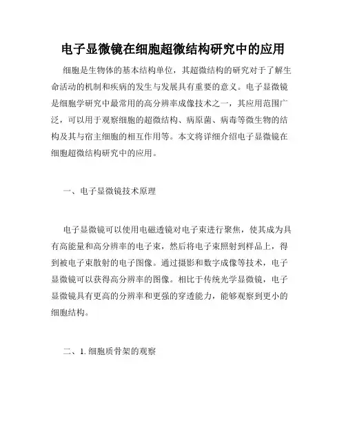 电子显微镜在细胞超微结构研究中的应用