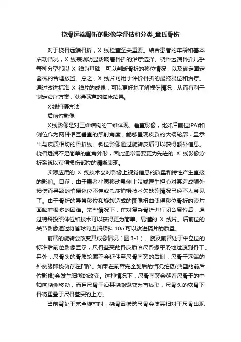 桡骨远端骨折的影像学评估和分类_章氏骨伤