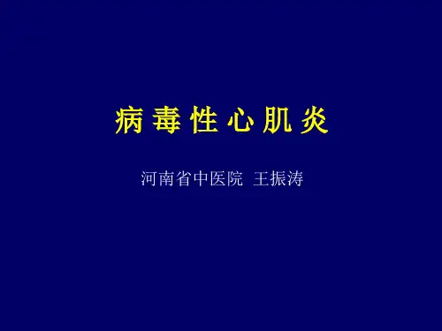 病毒性心肌炎