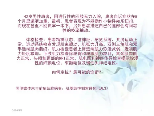运动神经元病PPT医学课件