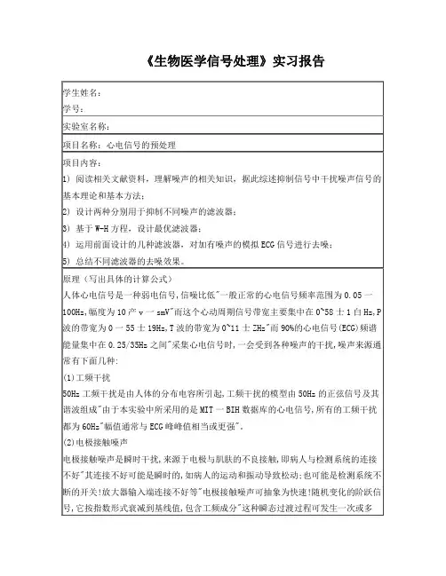 心电信号预处理