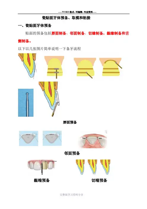 瓷贴面修复的操作事项