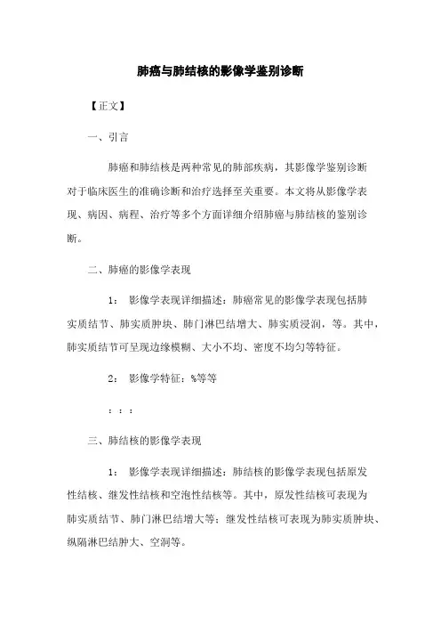 肺癌与肺结核的影像学鉴别诊断