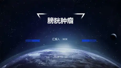 膀胱肿瘤PPT演示课件