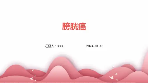 膀胱癌PPT演示课件