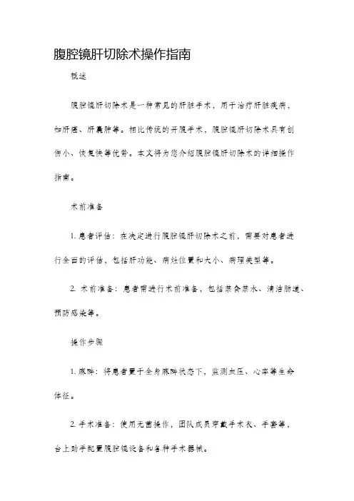 腹腔镜肝切除术操作指南