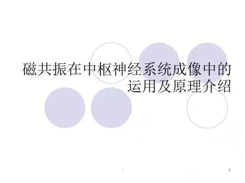 磁共振中枢神经系统PPT课件