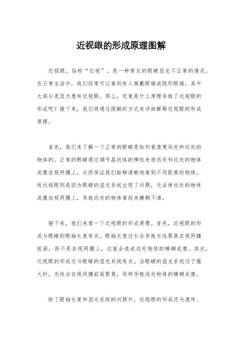 近视眼的形成原理图解