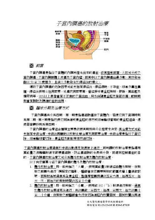 子宫内膜癌的放射治疗-台大医院