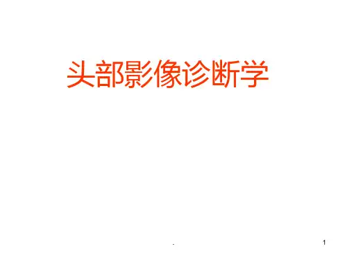颅脑CT诊断学